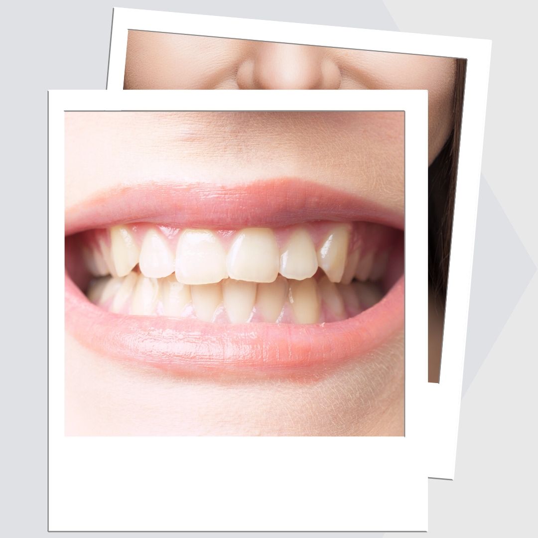 Are You Ready To See How We Can Transform Your Smile?